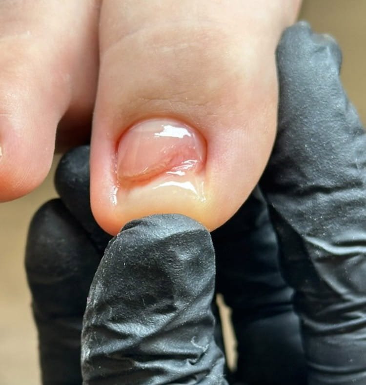 CMP Paramedical Pedicure Course